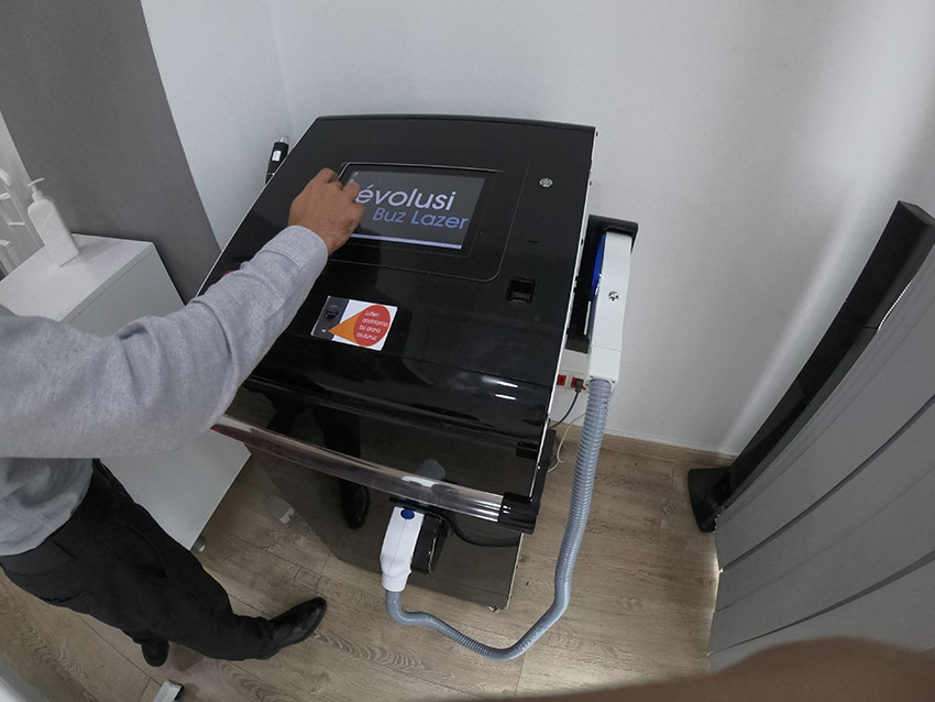 Smokin Lazer Epilasyon