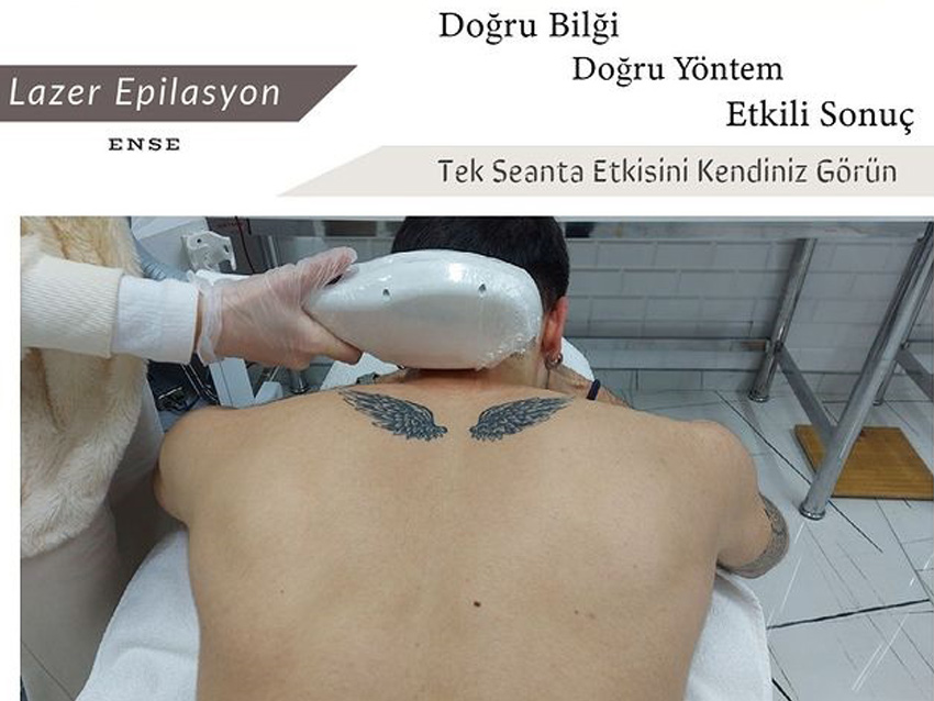 Dermo Park Erkek Lazer